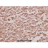 Anti-BCKDK (E41) Antibody from Bioworld Technology (BS1869) - Antibodies.com