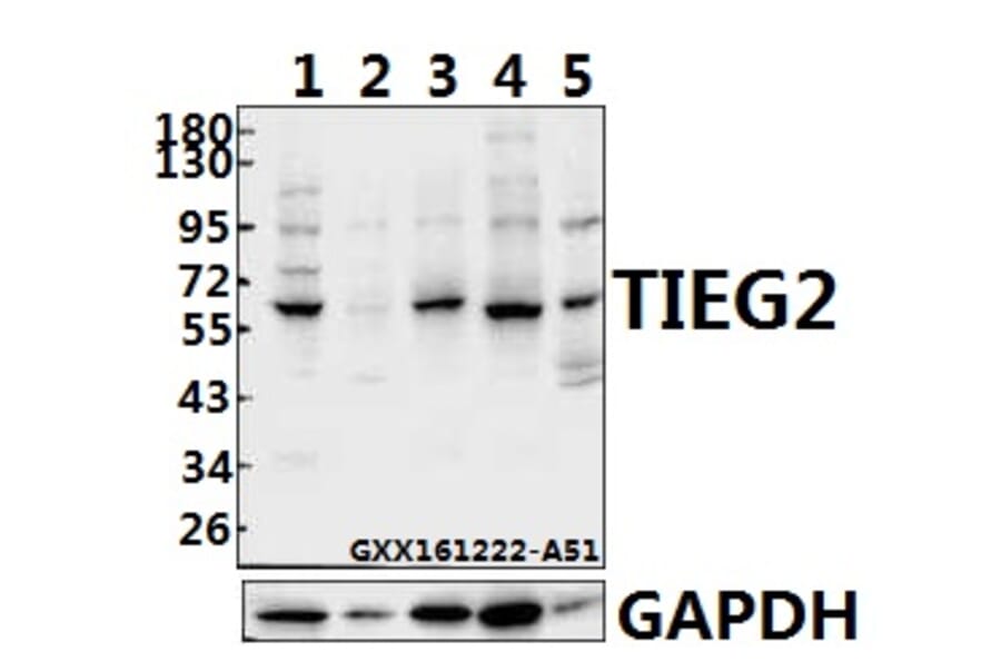 Anti-TIEG2 (F6) Antibody from Bioworld Technology (BS1870) - Antibodies.com