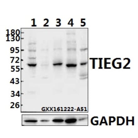 Anti-TIEG2 (F6) Antibody from Bioworld Technology (BS1870) - Antibodies.com