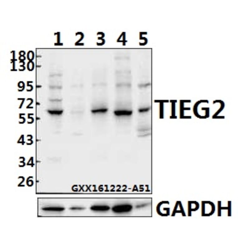 Anti-TIEG2 (F6) Antibody from Bioworld Technology (BS1870) - Antibodies.com