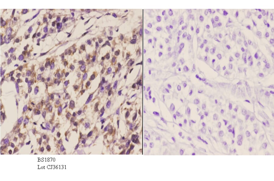 Anti-TIEG2 (F6) Antibody from Bioworld Technology (BS1870) - Antibodies.com