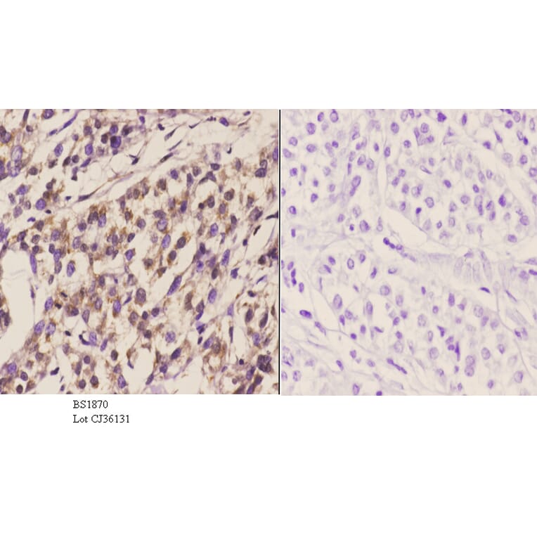 Anti-TIEG2 (F6) Antibody from Bioworld Technology (BS1870) - Antibodies.com