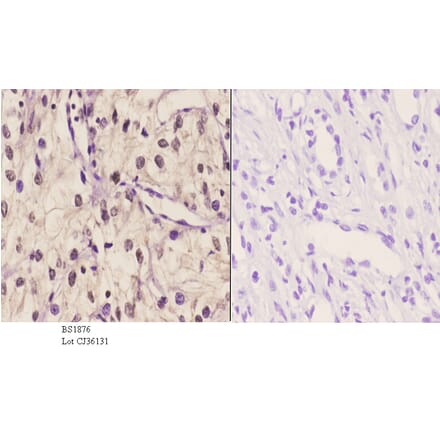 Anti-TBX1 (K347) Antibody from Bioworld Technology (BS1876) - Antibodies.com