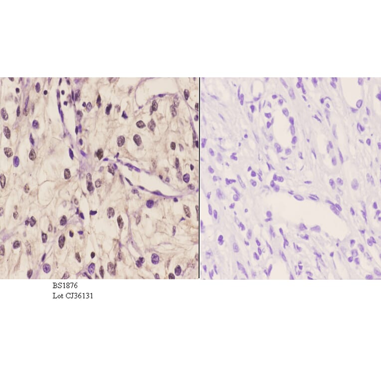 Anti-TBX1 (K347) Antibody from Bioworld Technology (BS1876) - Antibodies.com