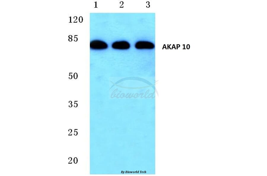 Anti-AKAP 10 (R27) Antibody from Bioworld Technology (BS1877) - Antibodies.com