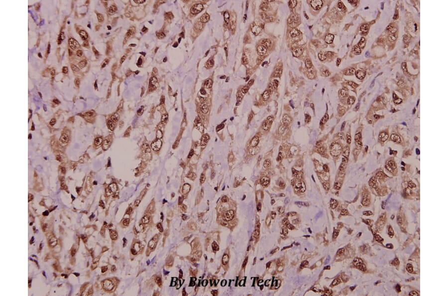 Anti-AKAP 10 (R27) Antibody from Bioworld Technology (BS1877) - Antibodies.com