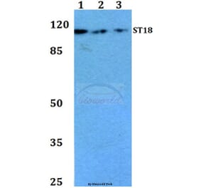 Anti-ST18 (E72) Antibody from Bioworld Technology (BS1881) - Antibodies.com