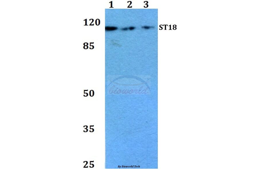 Anti-ST18 (E72) Antibody from Bioworld Technology (BS1881) - Antibodies.com