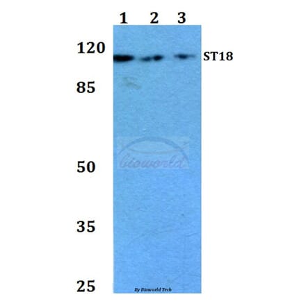 Anti-ST18 (E72) Antibody from Bioworld Technology (BS1881) - Antibodies.com