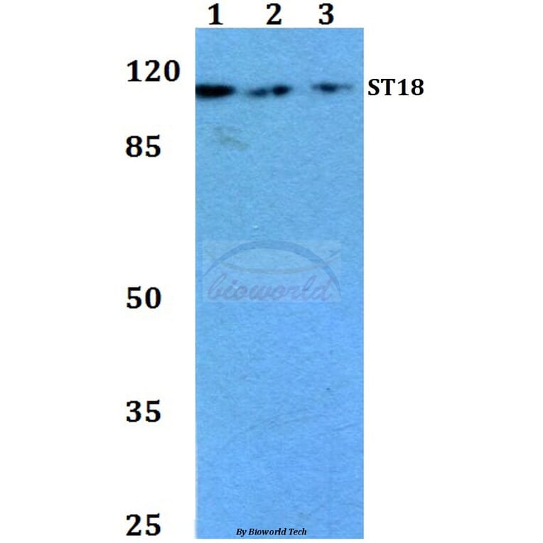 Anti-ST18 (E72) Antibody from Bioworld Technology (BS1881) - Antibodies.com