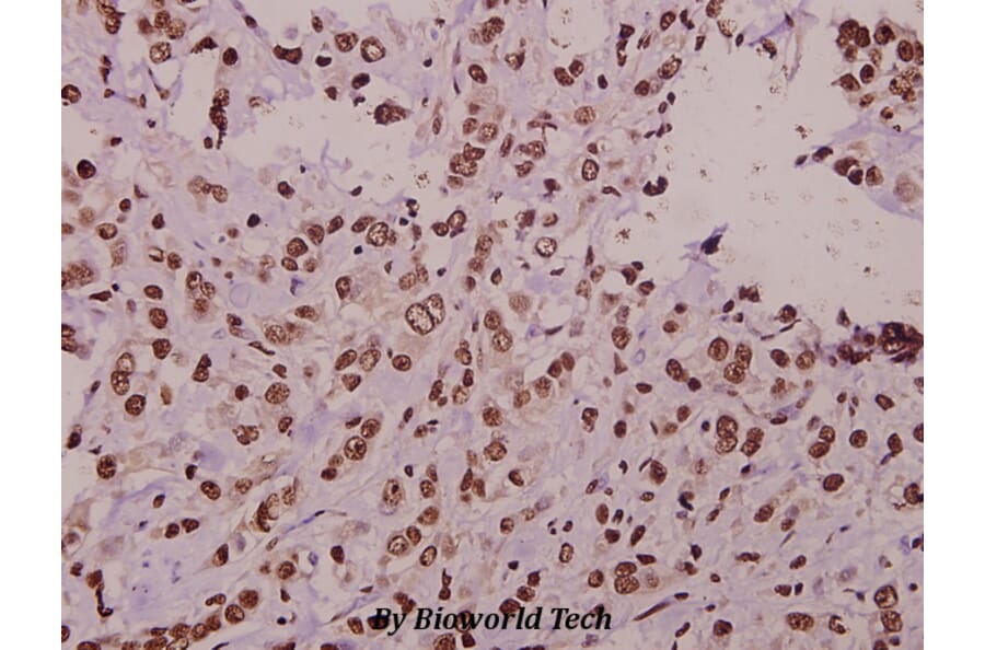 Anti-ST18 (E72) Antibody from Bioworld Technology (BS1881) - Antibodies.com