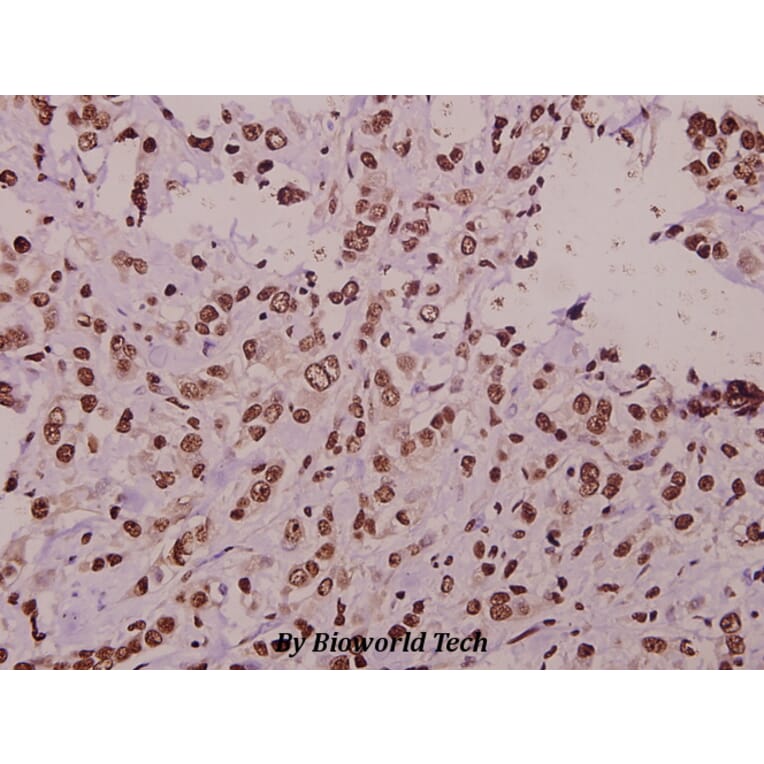 Anti-ST18 (E72) Antibody from Bioworld Technology (BS1881) - Antibodies.com