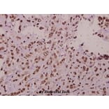 Anti-ST18 (E72) Antibody from Bioworld Technology (BS1881) - Antibodies.com