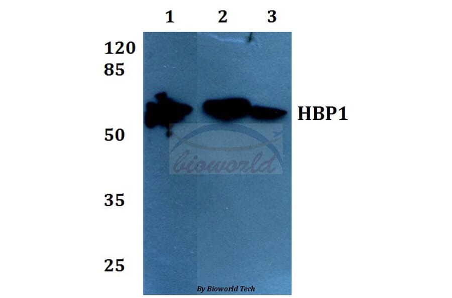 Anti-HBP1 (L468) Antibody from Bioworld Technology (BS1883) - Antibodies.com