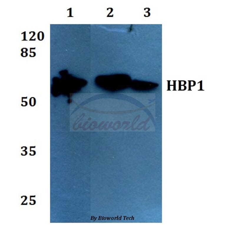 Anti-HBP1 (L468) Antibody from Bioworld Technology (BS1883) - Antibodies.com
