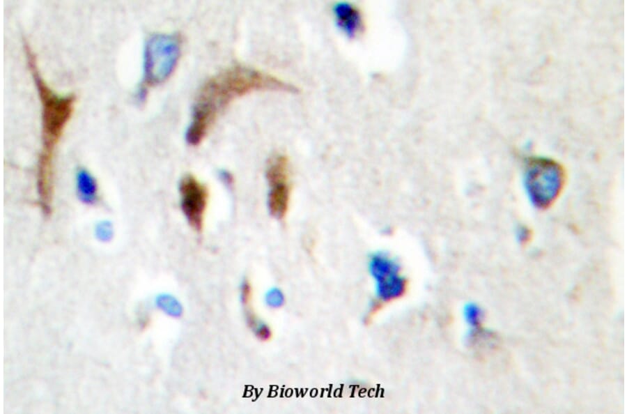 Anti-HBP1 (L468) Antibody from Bioworld Technology (BS1883) - Antibodies.com