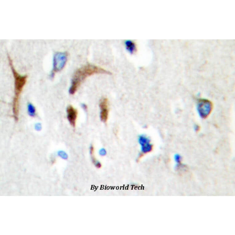 Anti-HBP1 (L468) Antibody from Bioworld Technology (BS1883) - Antibodies.com