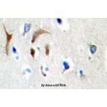 Anti-HBP1 (L468) Antibody from Bioworld Technology (BS1883) - Antibodies.com