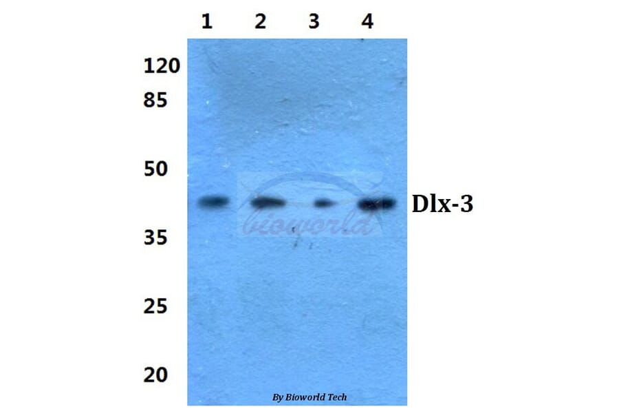 Anti-Dlx-3 (D107) Antibody from Bioworld Technology (BS1884) - Antibodies.com