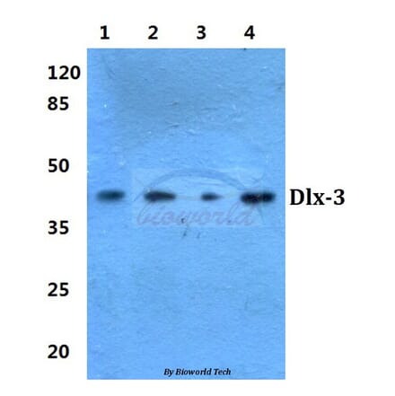 Anti-Dlx-3 (D107) Antibody from Bioworld Technology (BS1884) - Antibodies.com