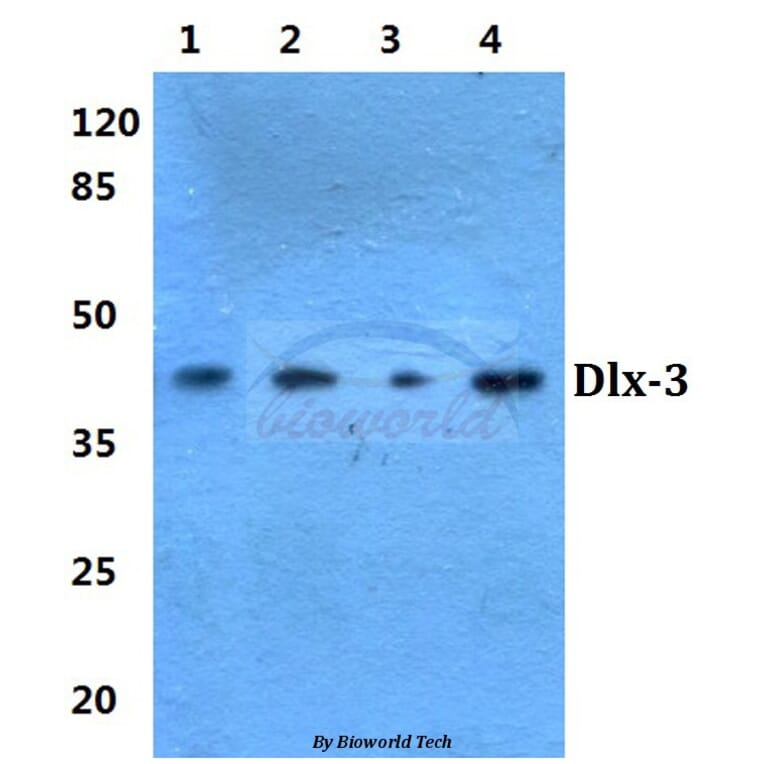 Anti-Dlx-3 (D107) Antibody from Bioworld Technology (BS1884) - Antibodies.com