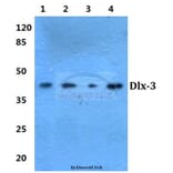 Anti-Dlx-3 (D107) Antibody from Bioworld Technology (BS1884) - Antibodies.com