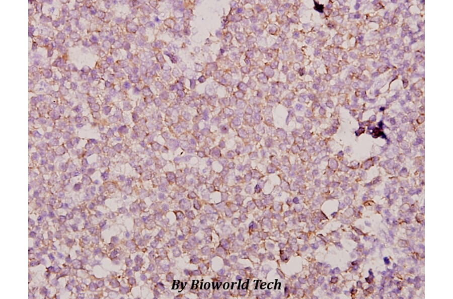 Anti-Dlx-3 (D107) Antibody from Bioworld Technology (BS1884) - Antibodies.com