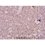 Anti-Dlx-3 (D107) Antibody from Bioworld Technology (BS1884) - Antibodies.com