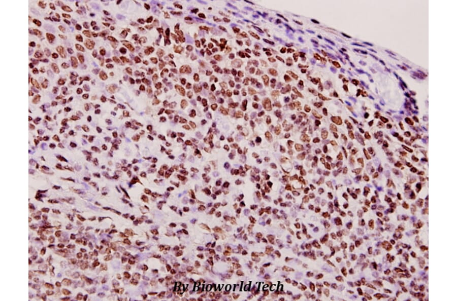 Anti-hnRNP Q (E268) Antibody from Bioworld Technology (BS1885) - Antibodies.com