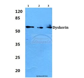 Anti-Dyskerin (K203) Antibody from Bioworld Technology (BS1887) - Antibodies.com