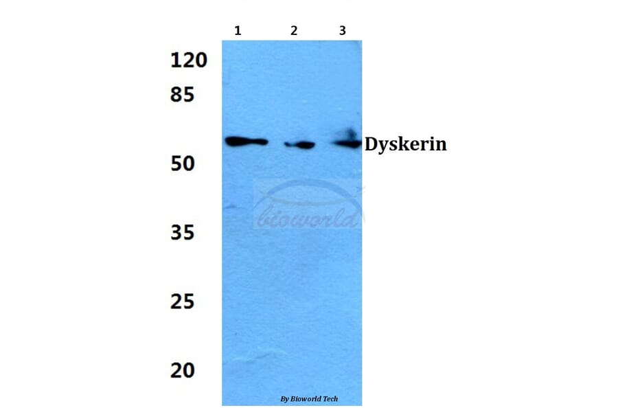Anti-Dyskerin (K203) Antibody from Bioworld Technology (BS1887) - Antibodies.com