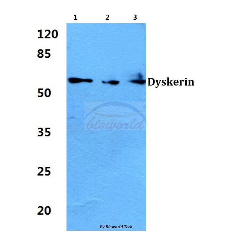Anti-Dyskerin (K203) Antibody from Bioworld Technology (BS1887) - Antibodies.com