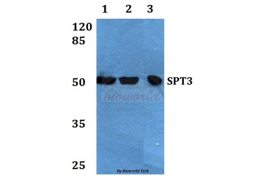 Anti-SPT3 (E203) Antibody from Bioworld Technology (BS1890) - Antibodies.com
