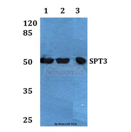 Anti-SPT3 (E203) Antibody from Bioworld Technology (BS1890) - Antibodies.com