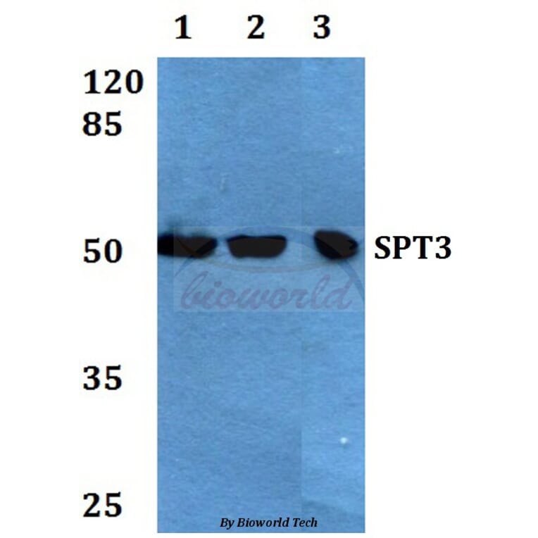 Anti-SPT3 (E203) Antibody from Bioworld Technology (BS1890) - Antibodies.com