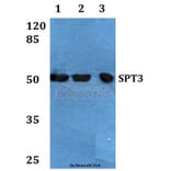 Anti-SPT3 (E203) Antibody from Bioworld Technology (BS1890) - Antibodies.com