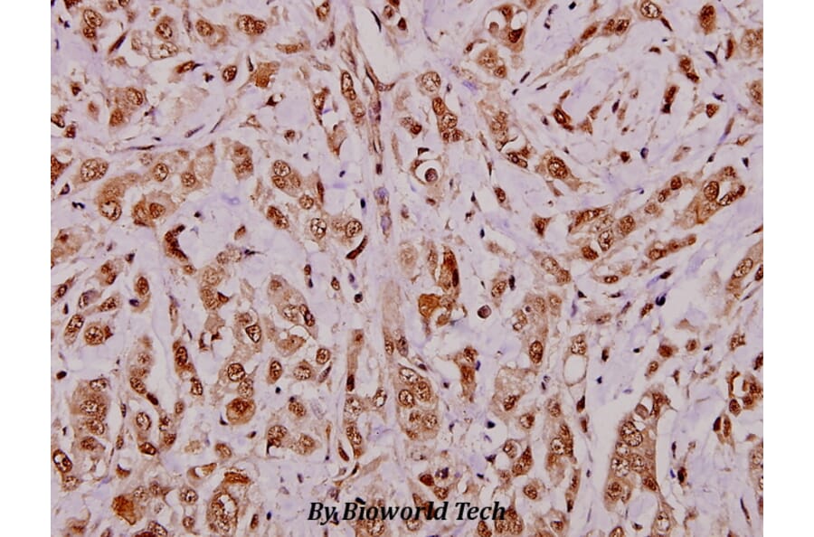 Anti-APRIL (S183) Antibody from Bioworld Technology (BS1893) - Antibodies.com