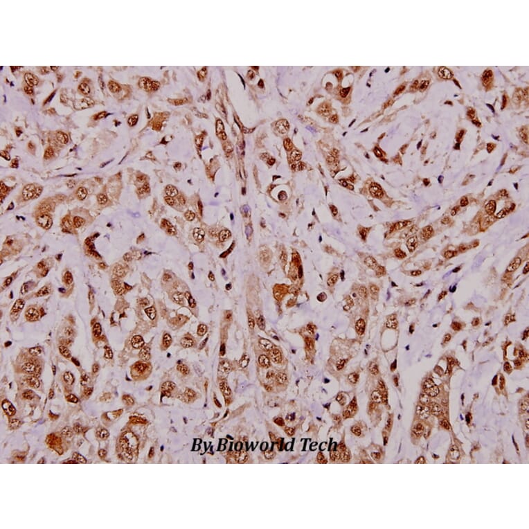 Anti-APRIL (S183) Antibody from Bioworld Technology (BS1893) - Antibodies.com