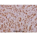 Anti-APRIL (S183) Antibody from Bioworld Technology (BS1893) - Antibodies.com