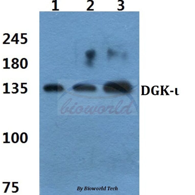 Anti-DGK-ι (K1023) Antibody from Bioworld Technology (BS1894) - Antibodies.com