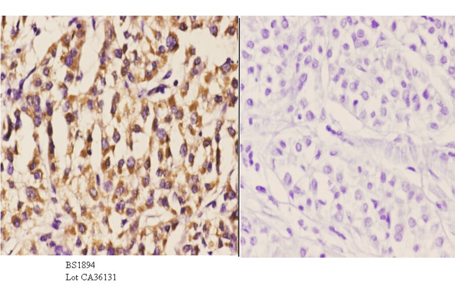 Anti-DGK-ι (K1023) Antibody from Bioworld Technology (BS1894) - Antibodies.com
