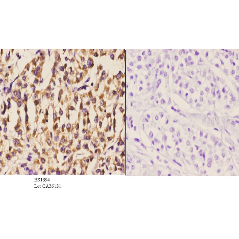 Anti-DGK-ι (K1023) Antibody from Bioworld Technology (BS1894) - Antibodies.com