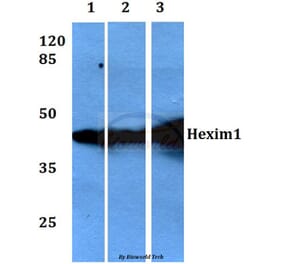 Anti-Hexim1 (Q215) Antibody from Bioworld Technology (BS1896) - Antibodies.com