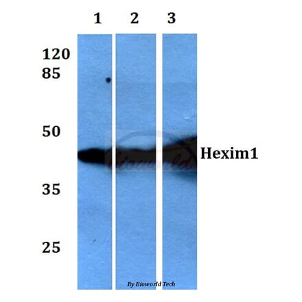 Anti-Hexim1 (Q215) Antibody from Bioworld Technology (BS1896) - Antibodies.com