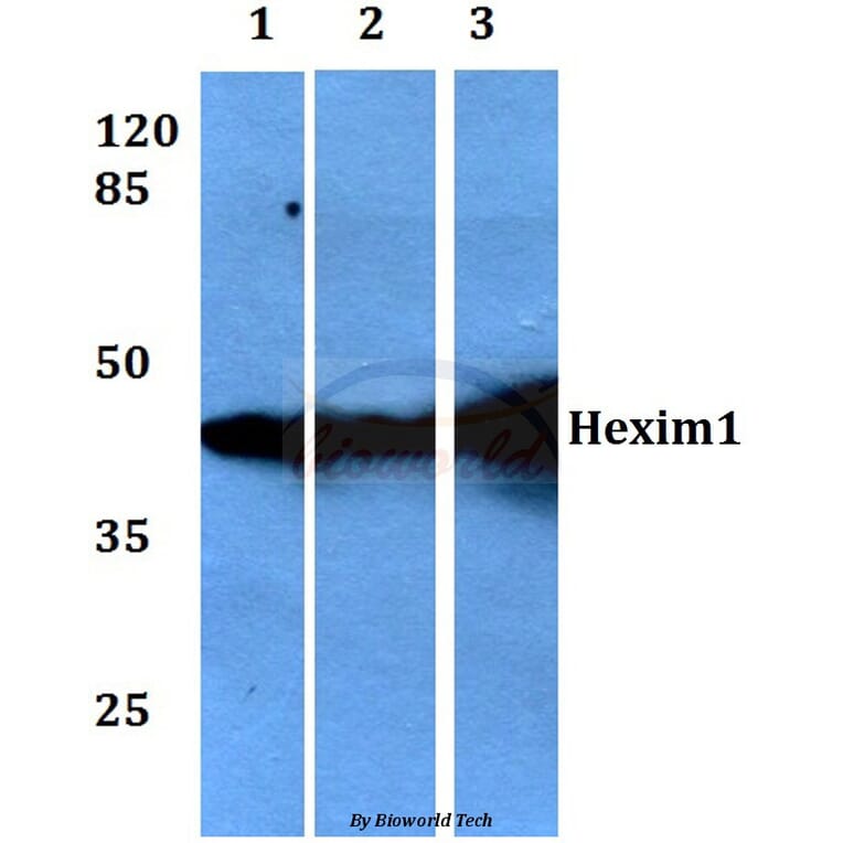 Anti-Hexim1 (Q215) Antibody from Bioworld Technology (BS1896) - Antibodies.com