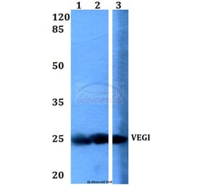 Anti-VEGI (F141) Antibody from Bioworld Technology (BS1899) - Antibodies.com