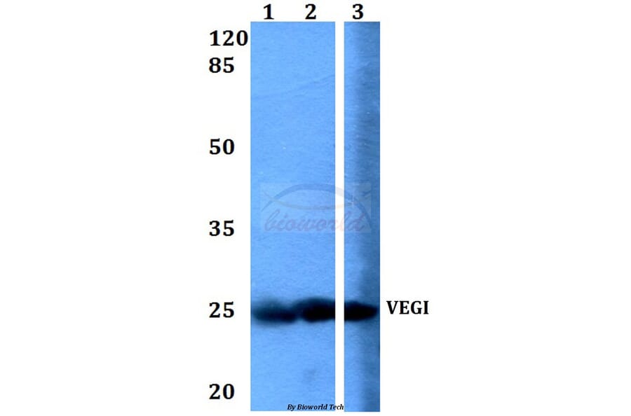 Anti-VEGI (F141) Antibody from Bioworld Technology (BS1899) - Antibodies.com