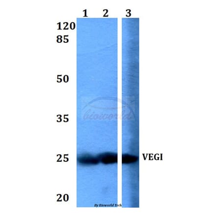 Anti-VEGI (F141) Antibody from Bioworld Technology (BS1899) - Antibodies.com