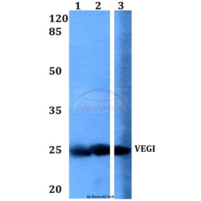 Anti-VEGI (F141) Antibody from Bioworld Technology (BS1899) - Antibodies.com