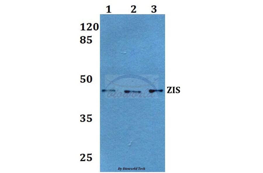 Anti-ZIS (I144) Antibody from Bioworld Technology (BS1900) - Antibodies.com